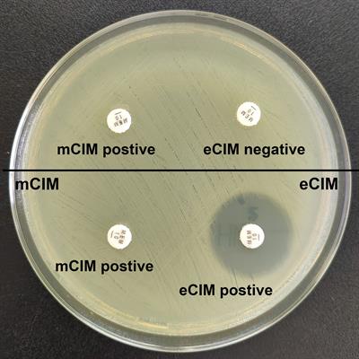 Carbapenem-resistant hypermucoviscous Klebsiella pneumoniae clinical isolates from a tertiary hospital in China: Antimicrobial susceptibility, resistance phenotype, epidemiological characteristics, microbial virulence, and risk factors